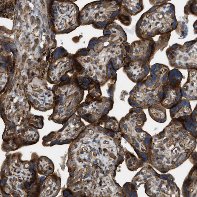 Immunohistochemistry (Formalin/PFA-fixed paraffin-embedded sections) - Anti-PHD2 / prolyl hydroxylase antibody (AB244389)