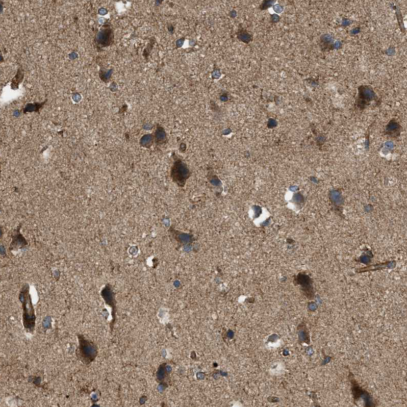 Immunohistochemistry (Formalin/PFA-fixed paraffin-embedded sections) - Anti-PHD2 / prolyl hydroxylase antibody (AB244389)