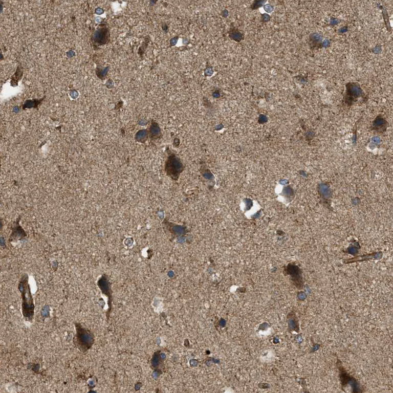 Immunohistochemistry (Formalin/PFA-fixed paraffin-embedded sections) - Anti-PHD2 / prolyl hydroxylase antibody (AB244389)