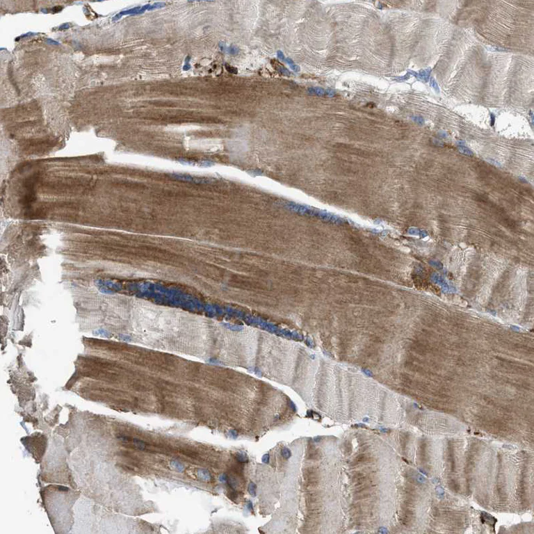Immunohistochemistry (Formalin/PFA-fixed paraffin-embedded sections) - Anti-PHD2 / prolyl hydroxylase antibody (AB244389)