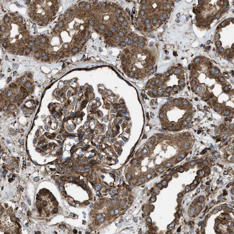 Immunohistochemistry (Formalin/PFA-fixed paraffin-embedded sections) - Anti-PHD2 / prolyl hydroxylase antibody (AB244389)