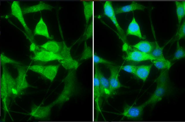 Immunocytochemistry/ Immunofluorescence - Anti-PHD2 / prolyl hydroxylase antibody - C-terminal (AB226890), expandable thumbnail