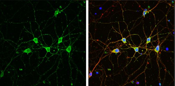 Immunocytochemistry/ Immunofluorescence - Anti-PHD2 / prolyl hydroxylase antibody - C-terminal (AB226890), expandable thumbnail