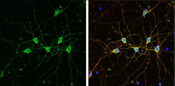 Immunocytochemistry/ Immunofluorescence - Anti-PHD2 / prolyl hydroxylase antibody - C-terminal (AB226890)