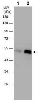 Western blot - Anti-PHD2 / prolyl hydroxylase antibody - C-terminal (AB226890), expandable thumbnail