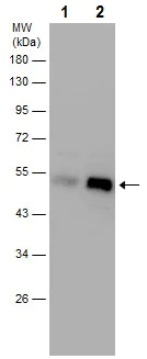 Western blot - Anti-PHD2 / prolyl hydroxylase antibody - C-terminal (AB226890)