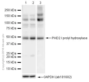 Western blot - Anti-PHD2 / prolyl hydroxylase antibody [EPR3660(B)(2)] (AB133630)