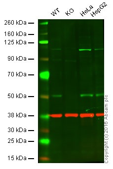 Western blot - Anti-PHD2 / prolyl hydroxylase antibody [EPR3660(B)(2)] - BSA and Azide free (AB232565), expandable thumbnail