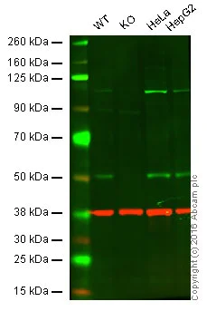 Western blot - Anti-PHD2 / prolyl hydroxylase antibody [EPR3660(B)(2)] - BSA and Azide free (AB232565)