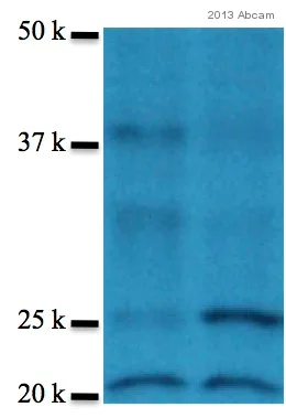 Western blot - Anti-PHD3 antibody (AB30782)