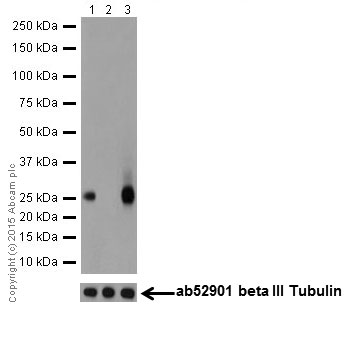 Western blot - Anti-PHD3 antibody [EPR17869] (AB184714), expandable thumbnail
