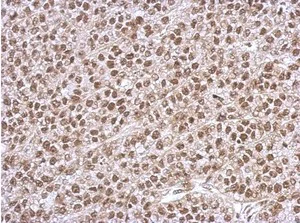 Immunohistochemistry (Formalin/PFA-fixed paraffin-embedded sections) - Anti-PHF10 antibody (AB154637)