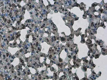 Immunohistochemistry (Formalin/PFA-fixed paraffin-embedded sections) - Anti-PHF10 antibody (AB154637)