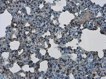 Immunohistochemistry (Formalin/PFA-fixed paraffin-embedded sections) - Anti-PHF10 antibody (AB154637)