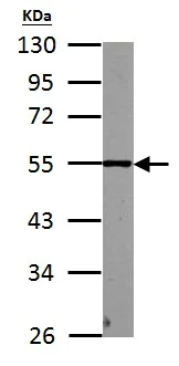 Western blot - Anti-PHF10 antibody (AB154637)