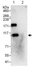 Immunoprecipitation - Anti-PHF16 antibody (AB129495)