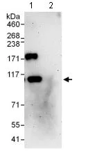 Immunoprecipitation - Anti-PHF16 antibody (AB129495)