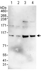 Western blot - Anti-PHF16 antibody (AB129495)