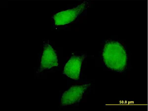 Immunocytochemistry/ Immunofluorescence - Anti-PHF17 antibody (AB66968)
