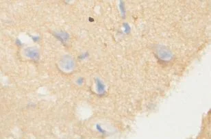 Immunohistochemistry (Formalin/PFA-fixed paraffin-embedded sections) - Anti-PHF20L1 antibody (AB118190)