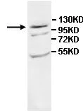Western blot - Anti-PHF20L1 antibody (AB118190)