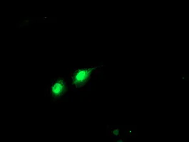 Immunocytochemistry/ Immunofluorescence - Anti-PHF21B antibody [OTI3D1] (AB119249)