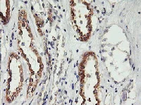 Immunohistochemistry (Formalin/PFA-fixed paraffin-embedded sections) - Anti-PHF21B antibody [OTI3D1] (AB119249)