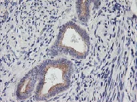 Immunohistochemistry (Formalin/PFA-fixed paraffin-embedded sections) - Anti-PHF21B antibody [OTI3D1] (AB119249)