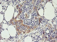 Immunohistochemistry (Formalin/PFA-fixed paraffin-embedded sections) - Anti-PHF21B antibody [OTI3D1] (AB119249)