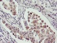Immunohistochemistry (Formalin/PFA-fixed paraffin-embedded sections) - Anti-PHF21B antibody [OTI3D1] (AB119249)