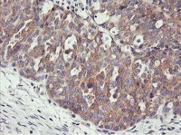 Immunohistochemistry (Formalin/PFA-fixed paraffin-embedded sections) - Anti-PHF21B antibody [OTI3D1] (AB119249)