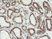 Immunohistochemistry (Formalin/PFA-fixed paraffin-embedded sections) - Anti-PHF21B antibody [OTI3D1] (AB119249)