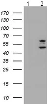 Western blot - Anti-PHF21B antibody [OTI3D1] (AB119249)