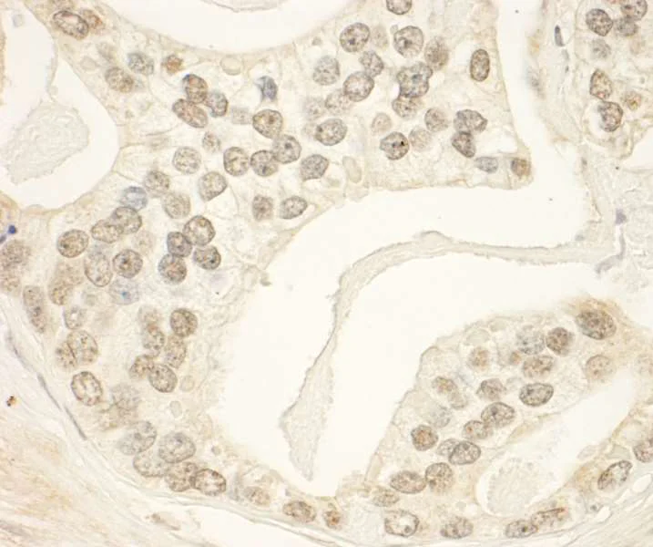 Immunohistochemistry (Formalin/PFA-fixed paraffin-embedded sections) - Anti-PHF23 antibody (AB264292)