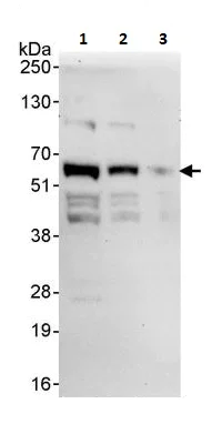 Western blot - Anti-PHF23 antibody (AB264292)