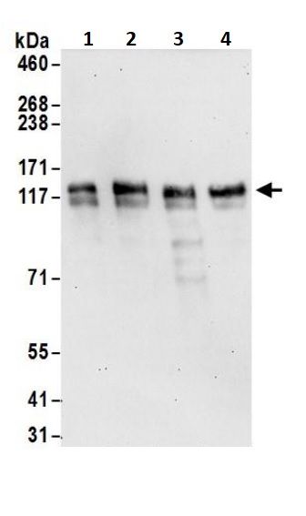 Western blot - Anti-PHF8 antibody (AB245589)