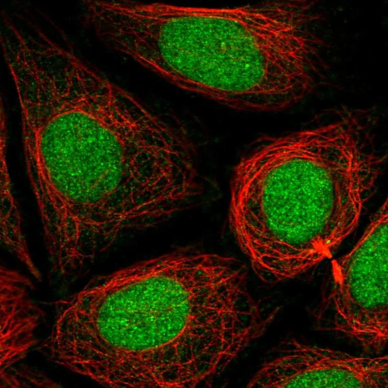 Immunocytochemistry/ Immunofluorescence - Anti-PHF8 Antibody (AB327252)
