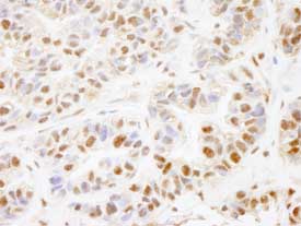 Immunohistochemistry (Formalin/PFA-fixed paraffin-embedded sections) - Anti-PHF8 antibody (AB84779)