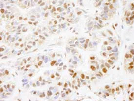 Immunohistochemistry (Formalin/PFA-fixed paraffin-embedded sections) - Anti-PHF8 antibody (AB84779)