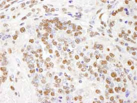 Immunohistochemistry (Formalin/PFA-fixed paraffin-embedded sections) - Anti-PHF8 antibody (AB84779)