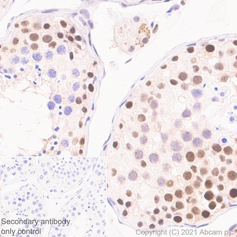 Immunohistochemistry (Formalin/PFA-fixed paraffin-embedded sections) - Anti-PHF8 antibody [EPR23913-57] (AB280887)