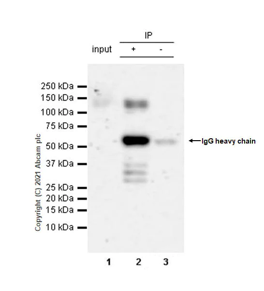 Immunoprecipitation - Anti-PHF8 antibody [EPR23913-57] (AB280887)