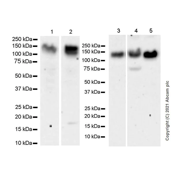 Western blot - Anti-PHF8 antibody [EPR23913-57] (AB280887)