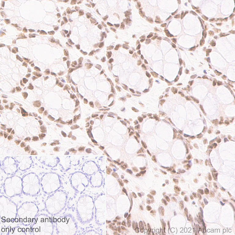 Immunohistochemistry (Formalin/PFA-fixed paraffin-embedded sections) - Anti-PHF8 antibody [EPR23913-57] - BSA and Azide free (AB280896)