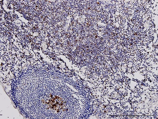 Immunohistochemistry (Formalin/PFA-fixed paraffin-embedded sections) - Anti-PHGDH/Malate dehydrogenase antibody [4A3-1D6] (AB57030)