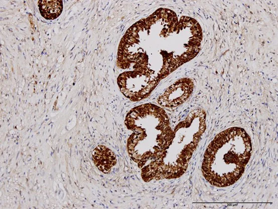 Immunohistochemistry (Formalin/PFA-fixed paraffin-embedded sections) - Anti-PHGDH/Malate dehydrogenase antibody [4A3-1D6] (AB57030)