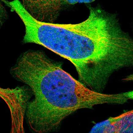 Immunocytochemistry - Anti-PHGDH/Malate dehydrogenase antibody (AB211365)