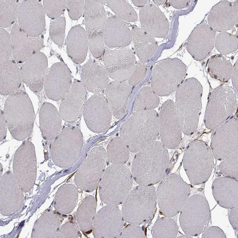 Immunohistochemistry (Formalin/PFA-fixed paraffin-embedded sections) - Anti-PHGDH/Malate dehydrogenase antibody (AB211365)