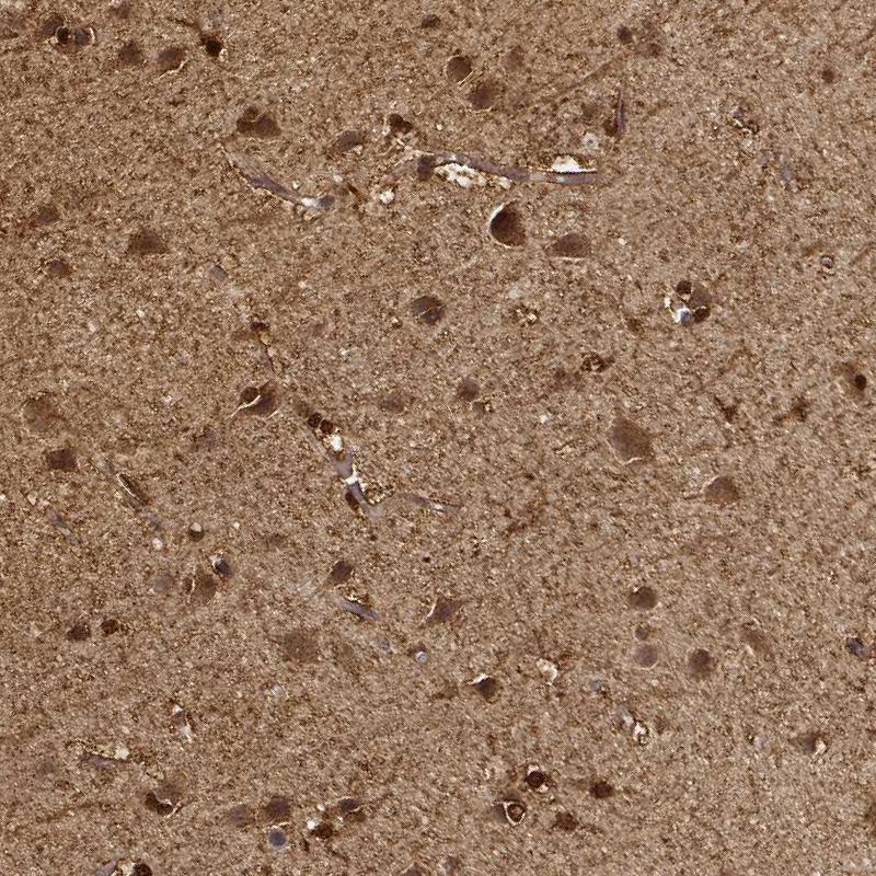 Immunohistochemistry (Formalin/PFA-fixed paraffin-embedded sections) - Anti-PHGDH/Malate dehydrogenase antibody (AB211365)