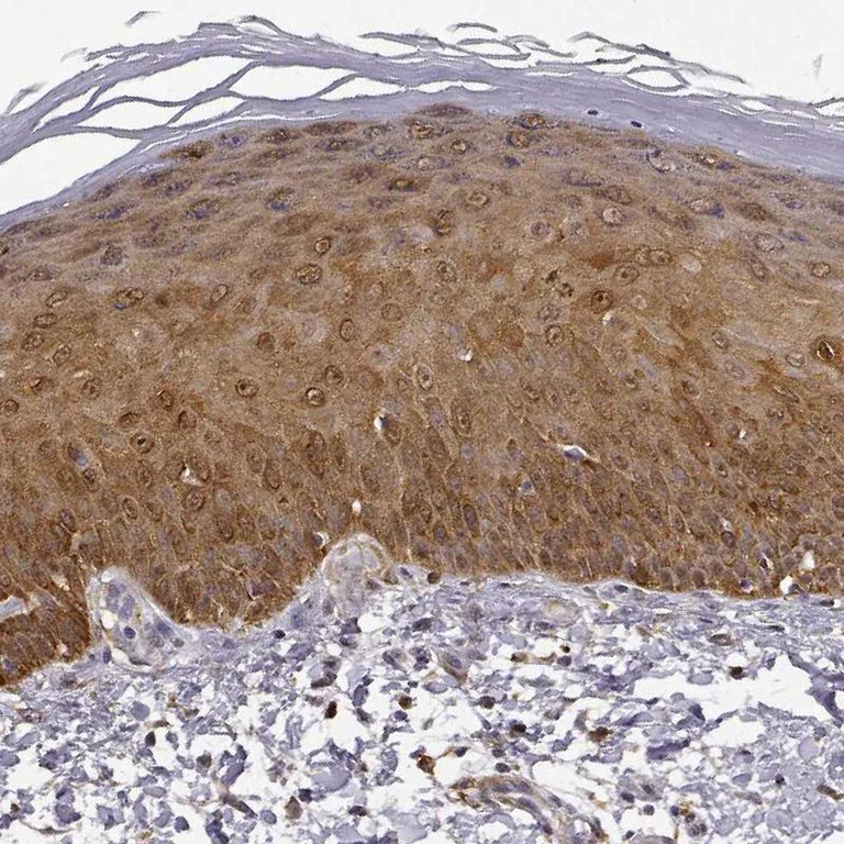 Immunohistochemistry (Formalin/PFA-fixed paraffin-embedded sections) - Anti-PHGDH/Malate dehydrogenase antibody (AB211365)